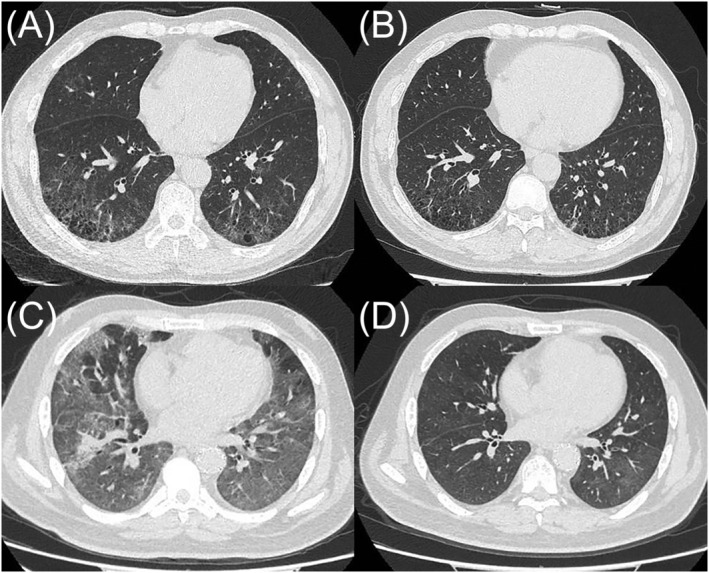 FIGURE 3