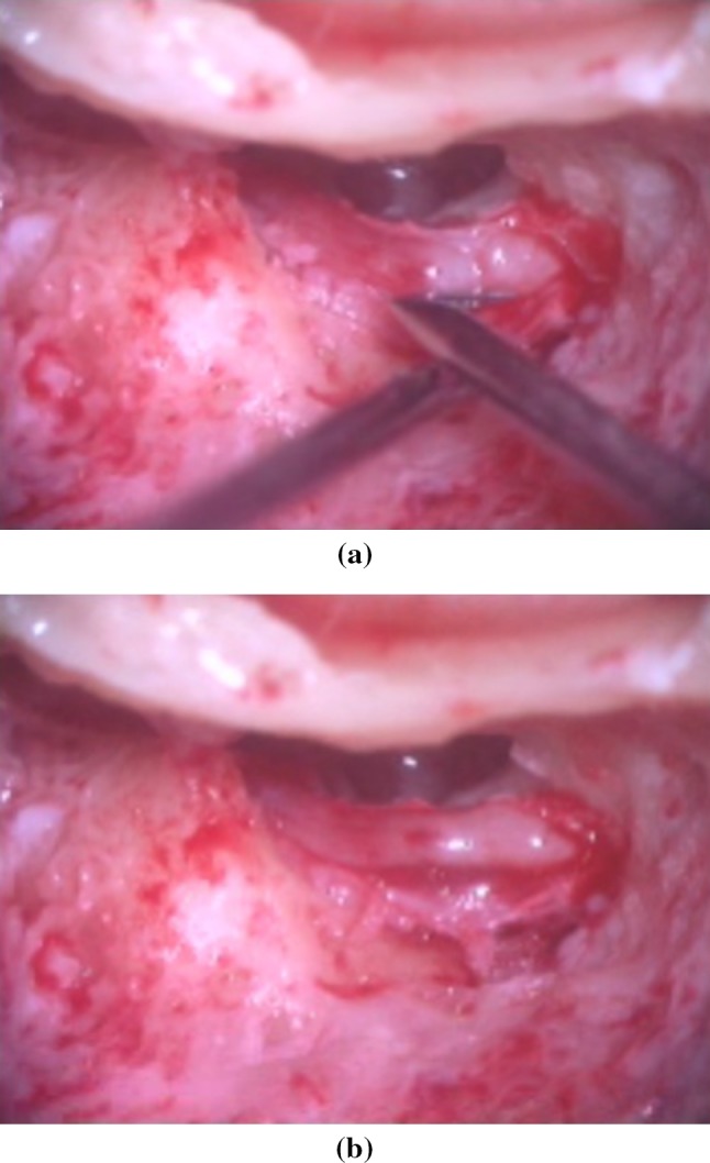 Fig. 3