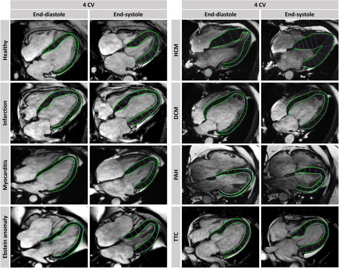 Fig. 4