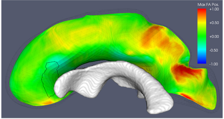 Fig. 16