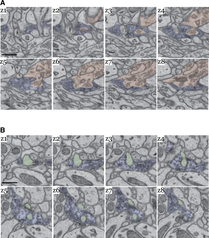 Figure 5—figure supplement 1.