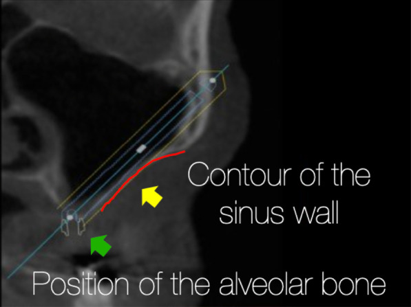 Fig. 30