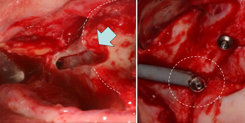 Fig. 7