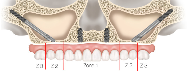 Fig. 28