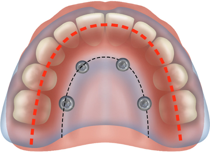 Fig. 34