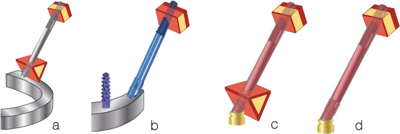 Fig. 12