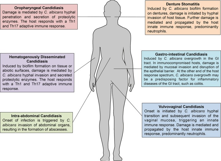 FIG 1