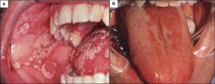 FIG 3