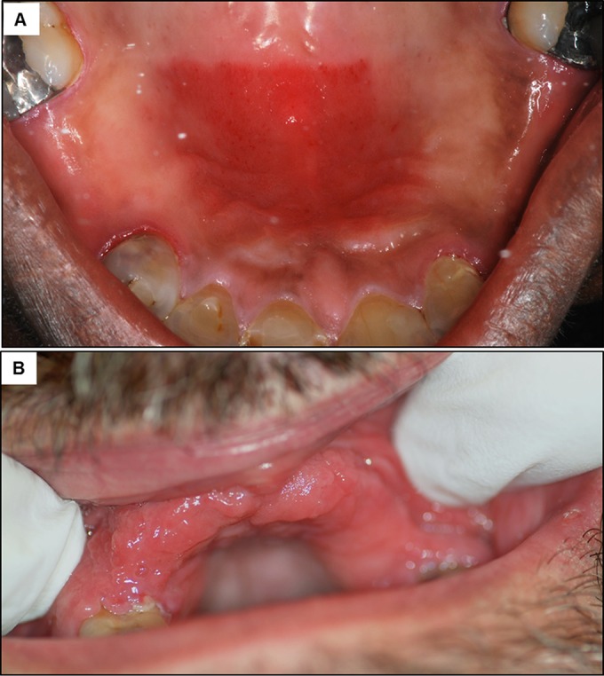 FIG 5