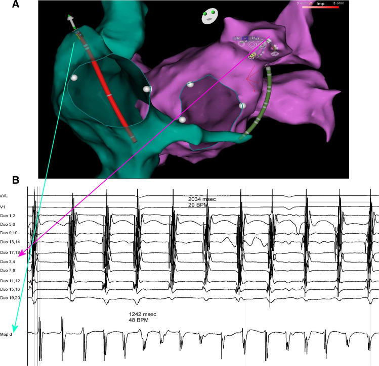 Fig. 1