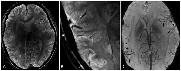 FIG 3