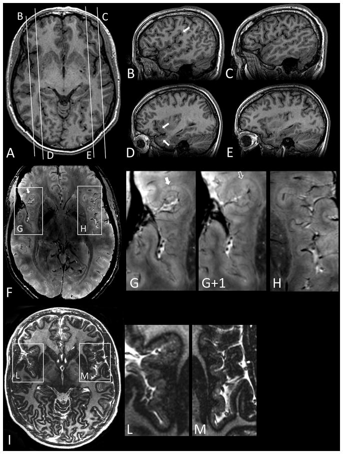 FIG 1