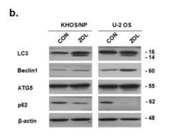 graphic file with name cancers-12-01359-i002.jpg