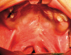Fig. 13.
