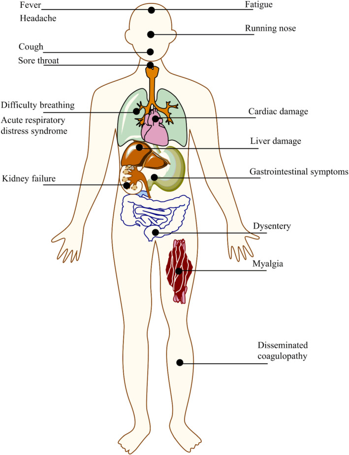 FIGURE 1