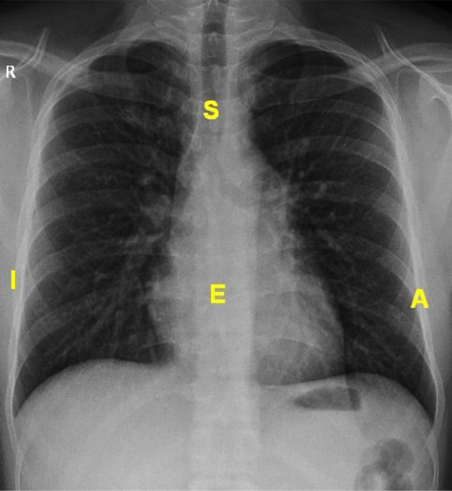 Fig. 2