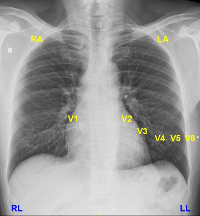 Fig. 1