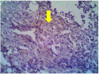 Fig. 2