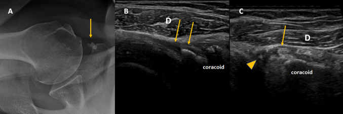 Fig. 4