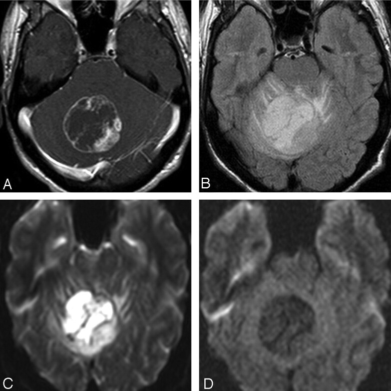 Fig 3.