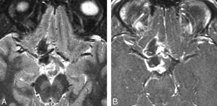 Fig 5.