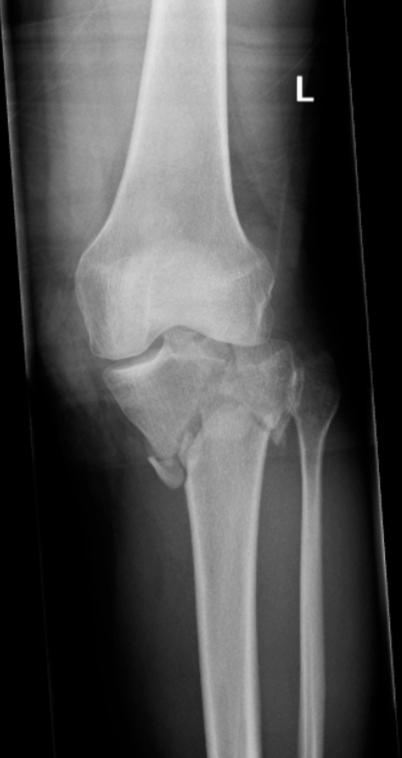 Fig. (1)