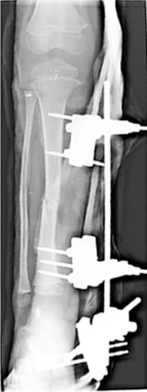 Fig. (4)