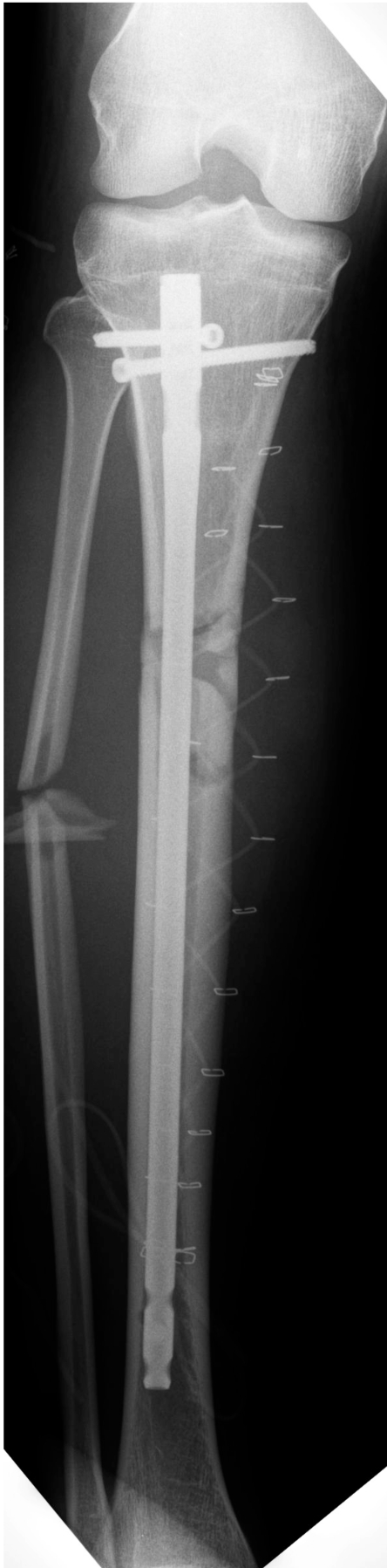 Fig. (3)