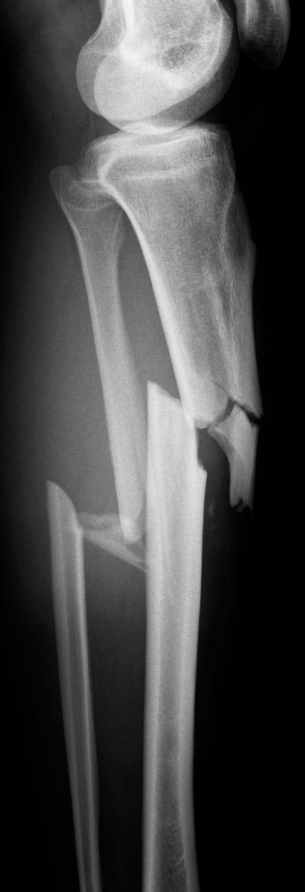 Fig. (2)
