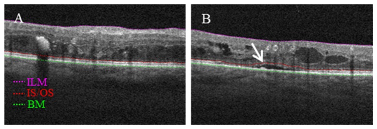 Fig. 3