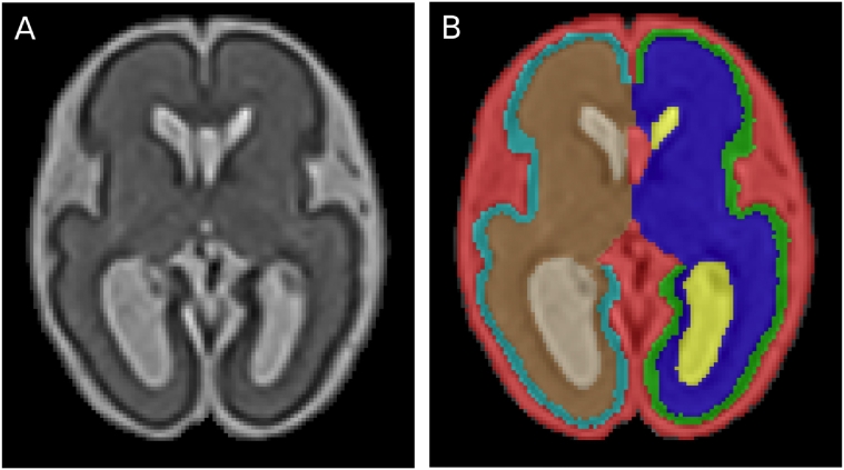 Fig. 2