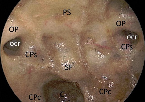 Figure 3: