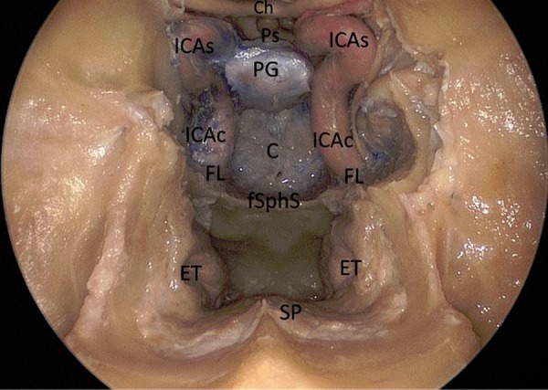 Figure 1: