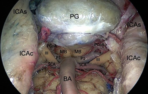 Figure 6: