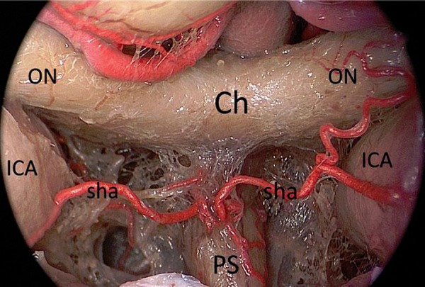 Figure 4: