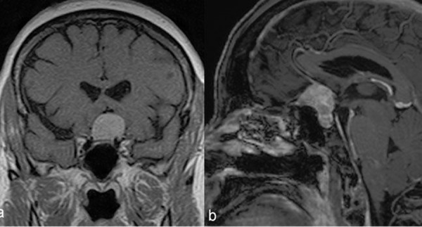 Figure 11: