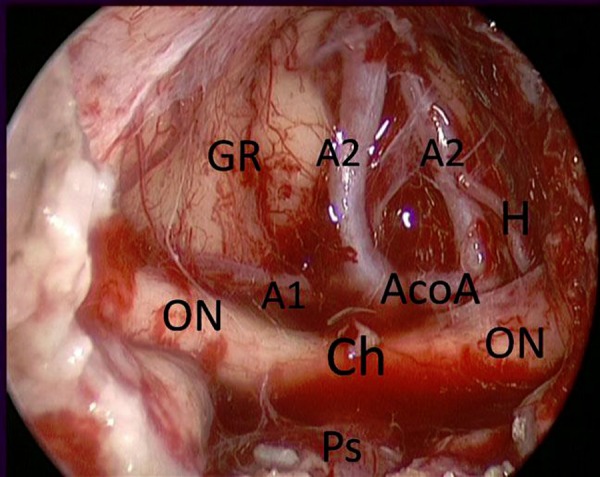 Figure 12: