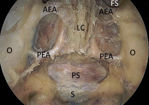 Figure 2: