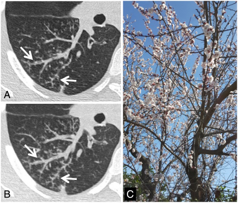 Fig. 33