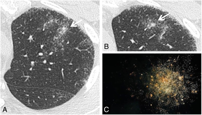 Fig. 15