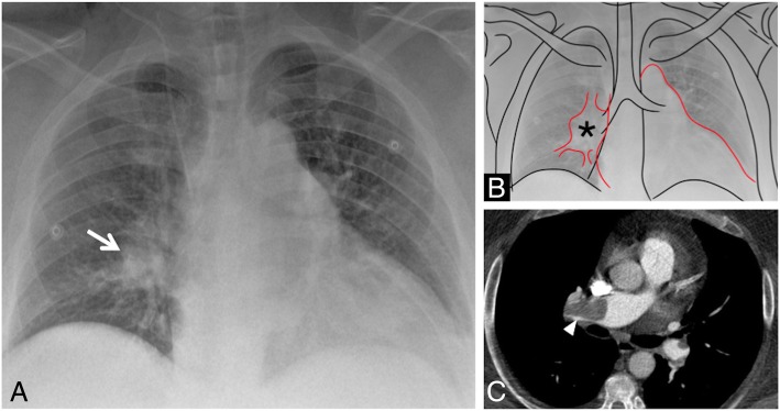 Fig. 13