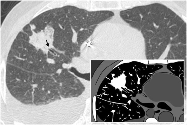 Fig. 27