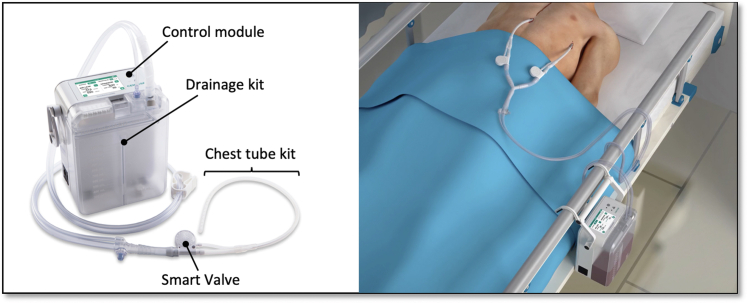 Figure 1