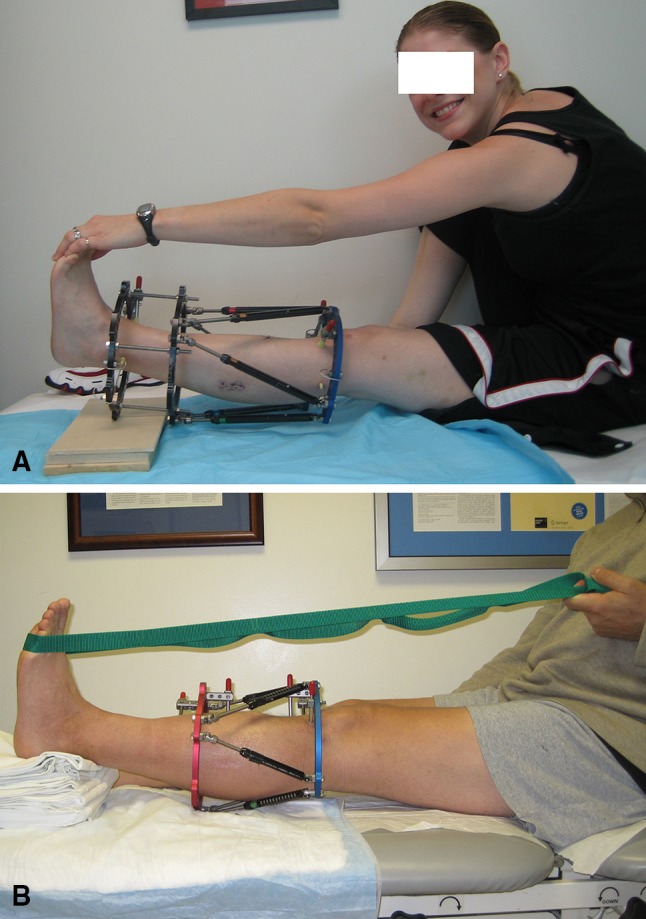 Fig. 1A–B