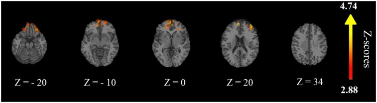 Fig. 2