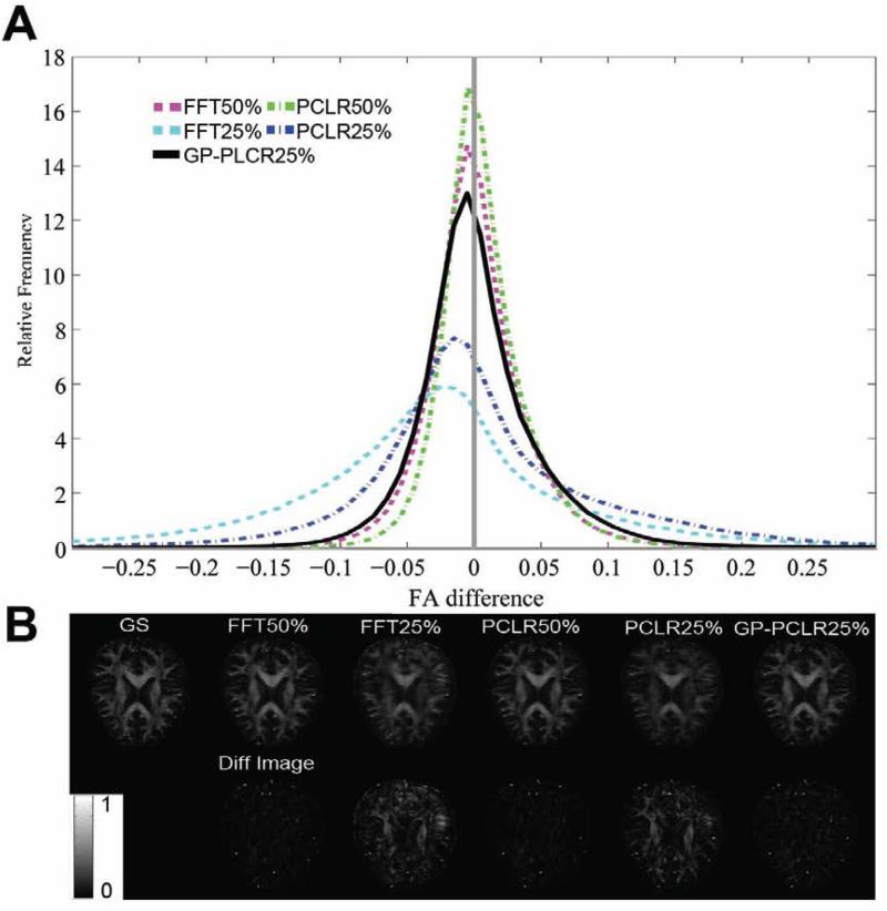 FIG.4