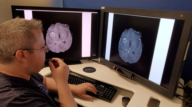 Eye-tracking setup. The user is looking at the monitor on the right while dictating into a microphone in his right hand. The gaze position appears on the left monitor as a small green dot.