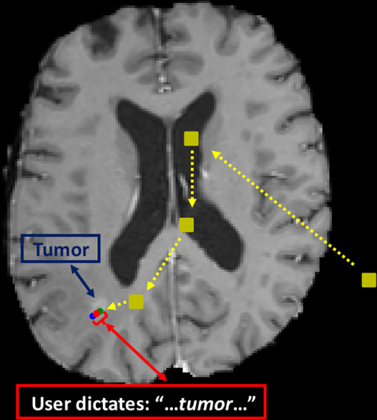 Example gaze plot. Initial points viewed are shown as yellow squares. The gaze position corresponding to the beginning of speaking the keyword is the green dot, and that for the end of the word is the blue dot. We take the average point (red dot) as the extracted label.