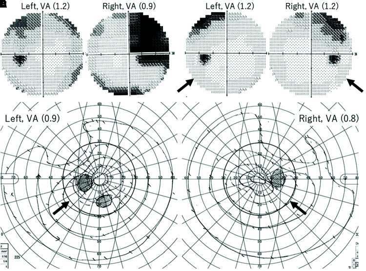 Fig. 4