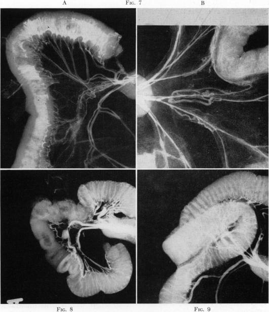 Fig. 7., Fig. 8., Fig. 9.